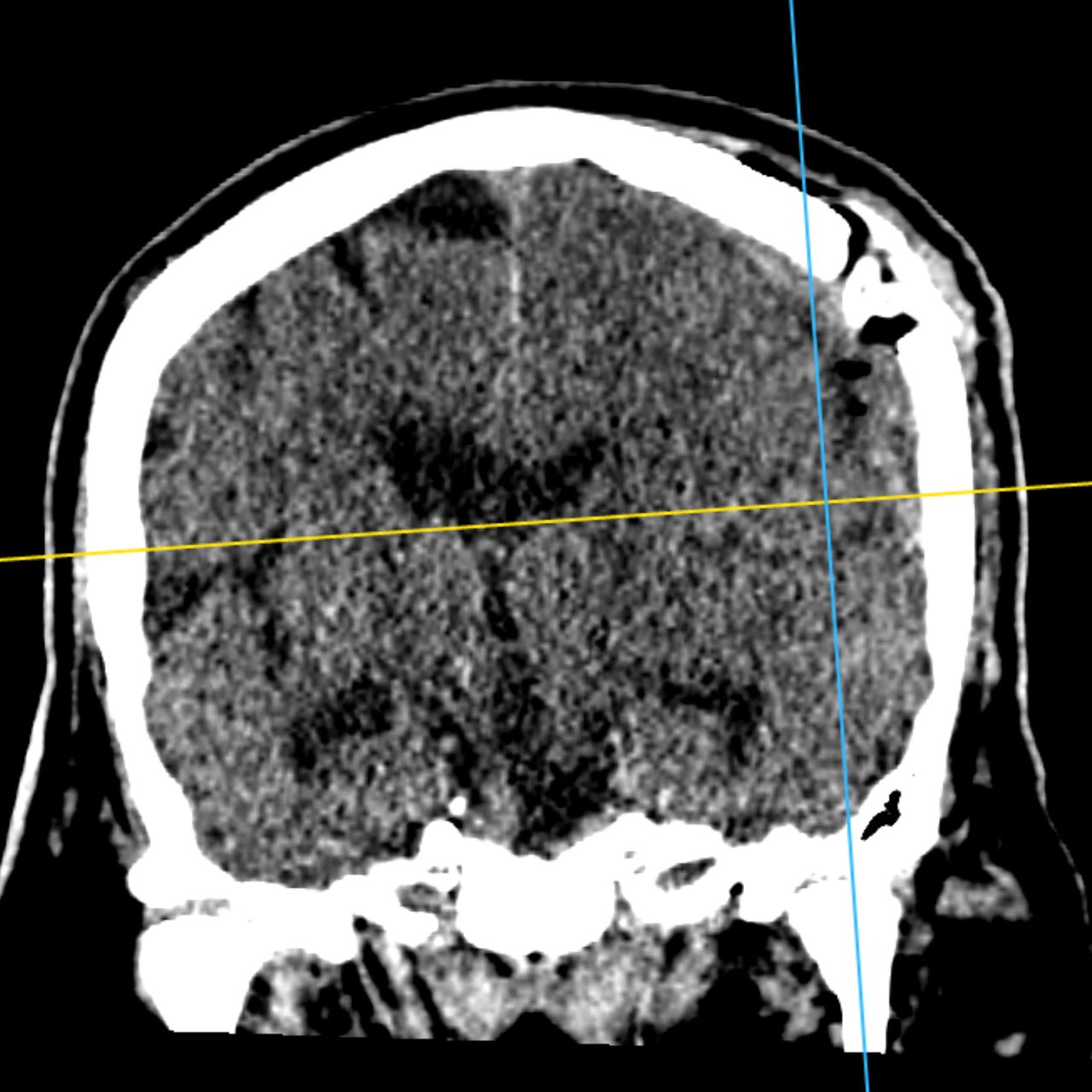 David Tafur Muñoz-1548
