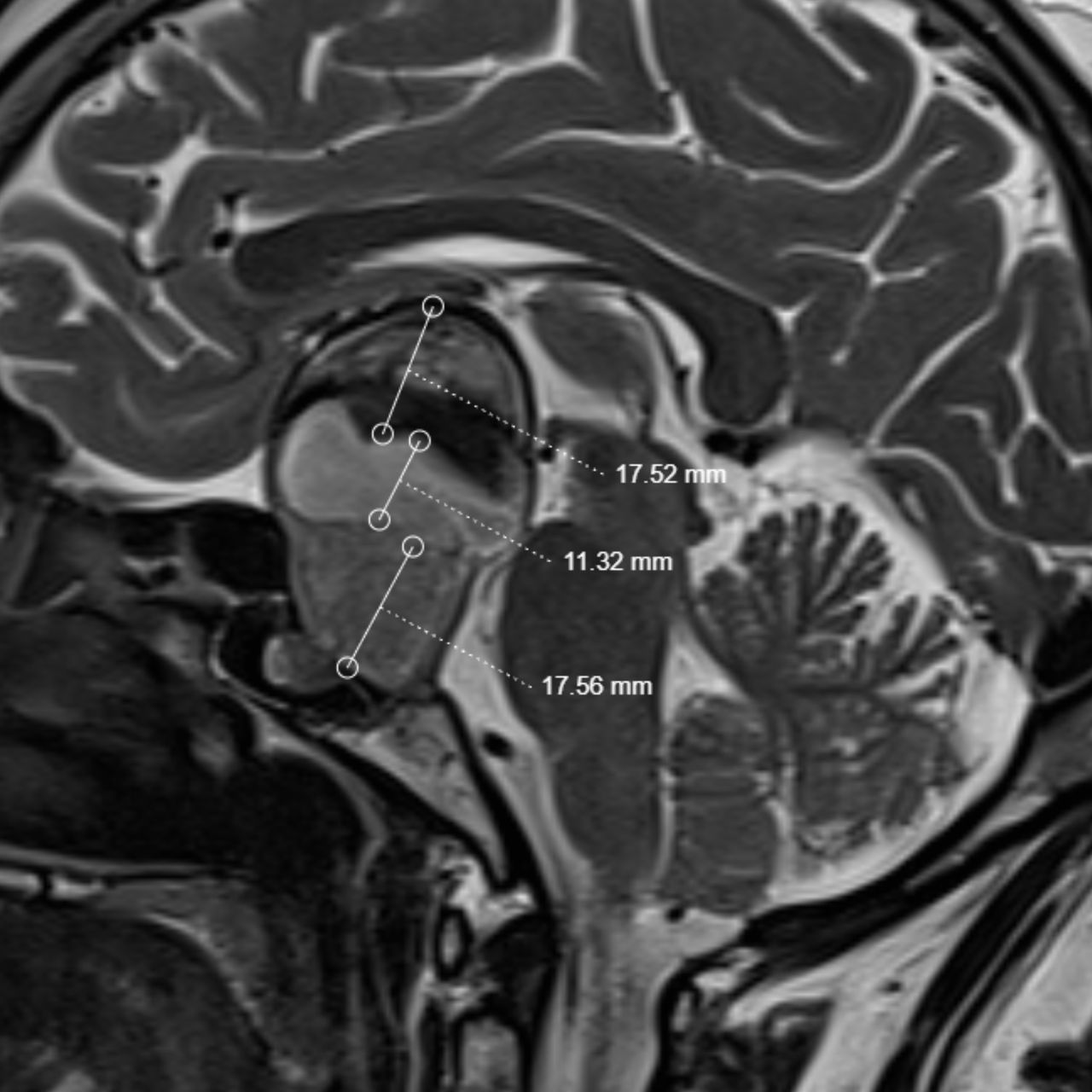 David Tafur Muñoz-1442