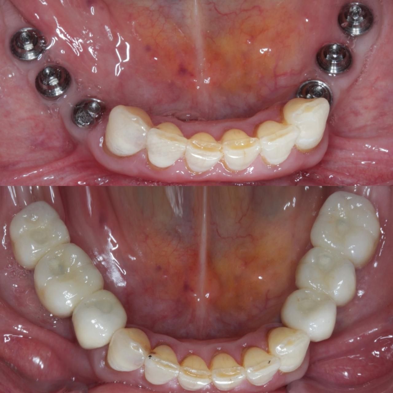 Antônio Alegria Do Nascimento-3