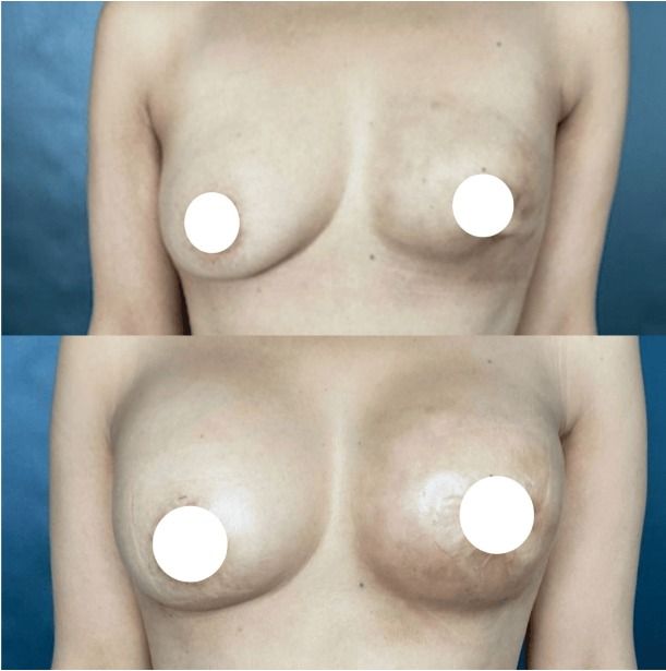 Ana Lucia Rave Martinez-8