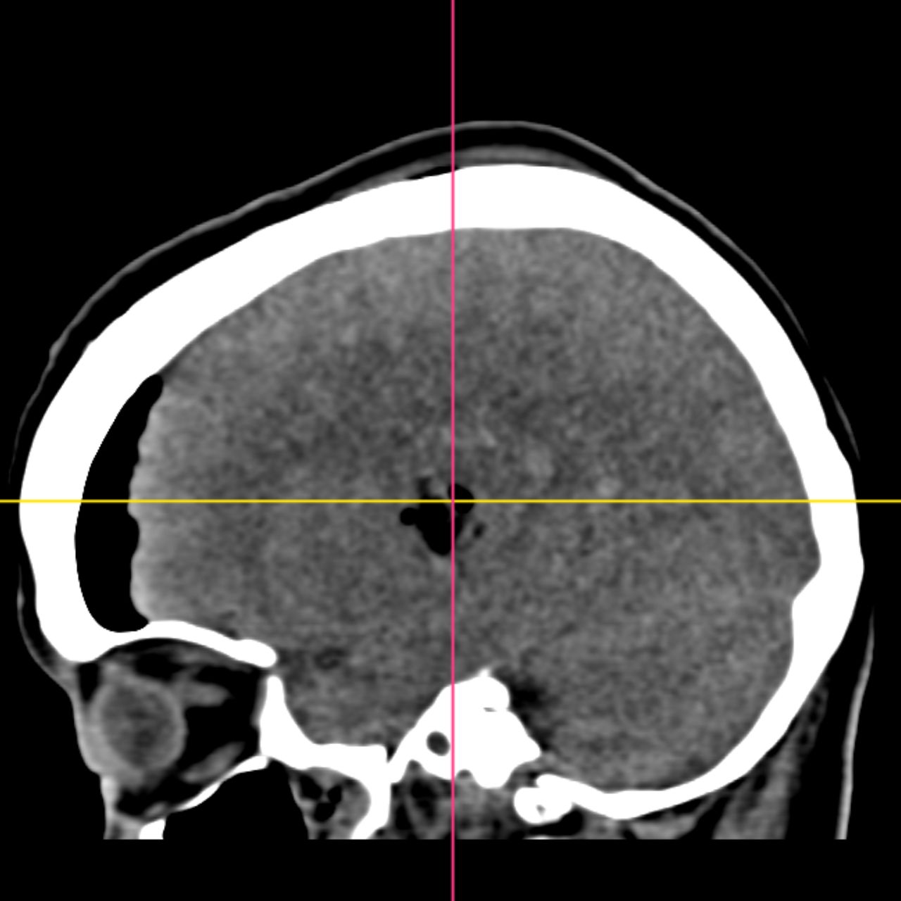 David Tafur Muñoz-2084