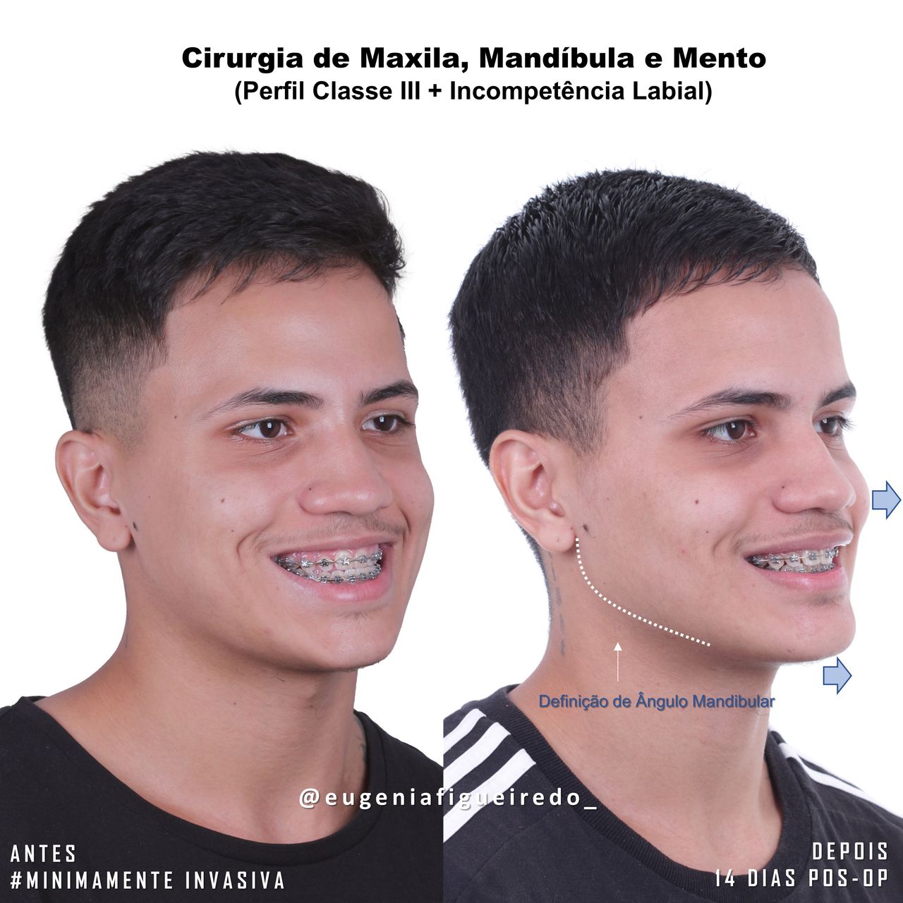 Eugênia Figueiredo-8