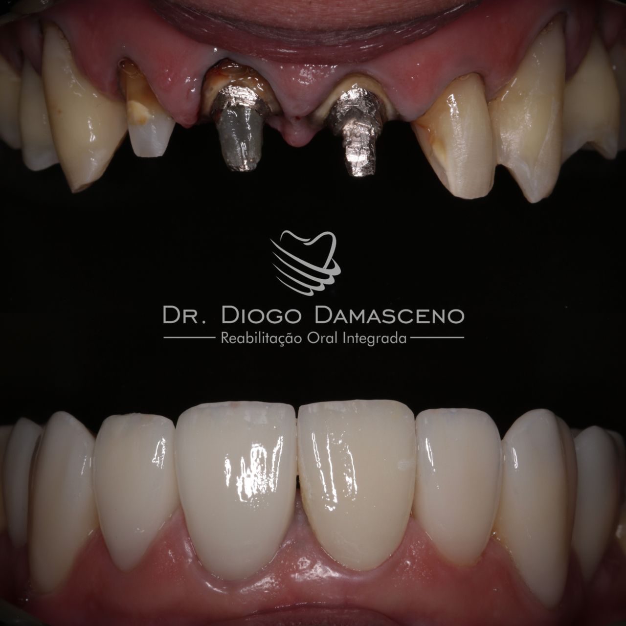 Diogo Damasceno-24