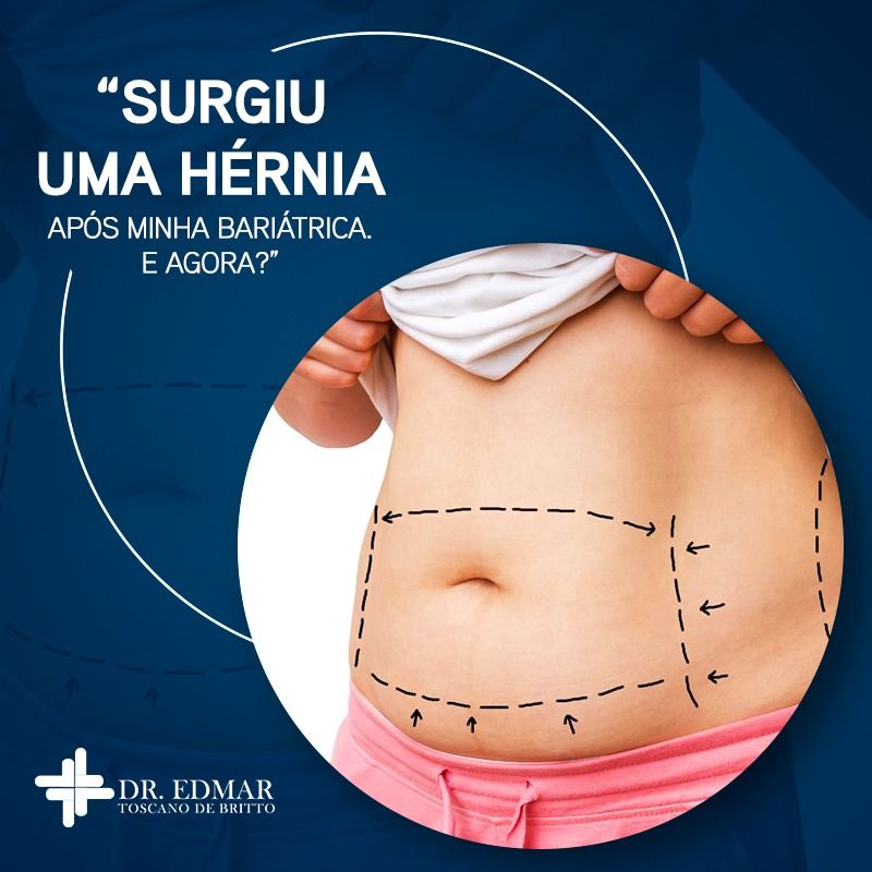 Edmar Toscano De Britto-12