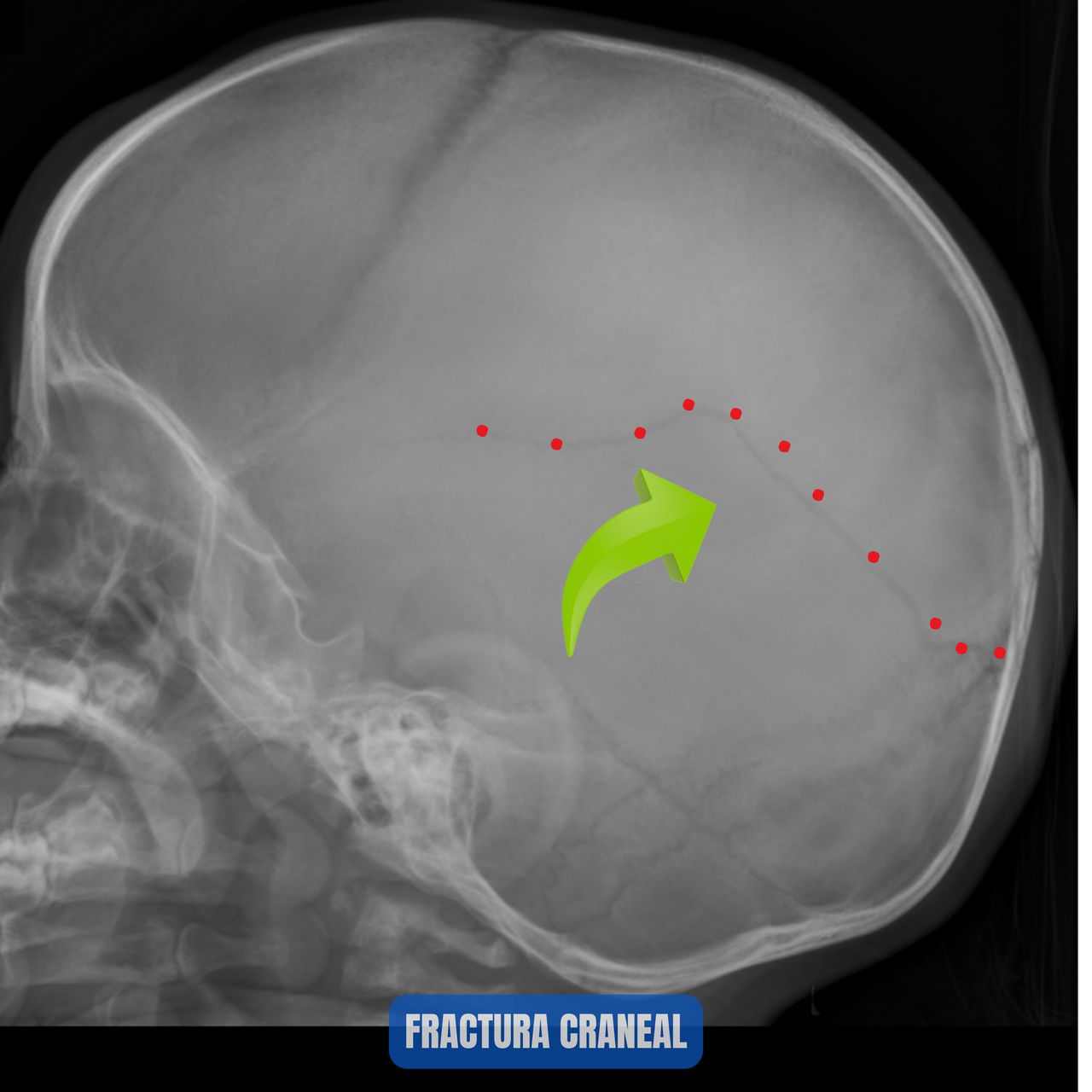 David Tafur Muñoz-1732