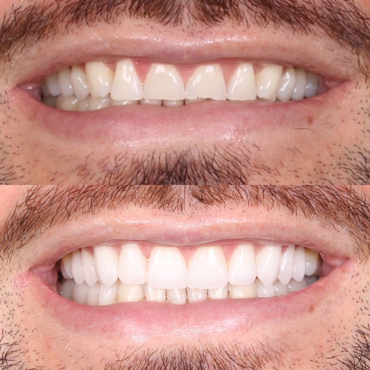 Caroline Benedeti-26