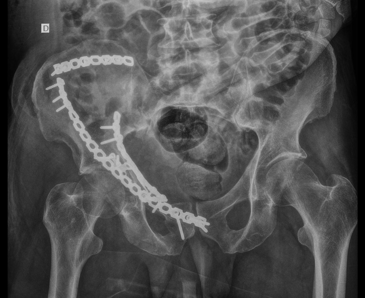 João Mauro Mendina De Morais-5