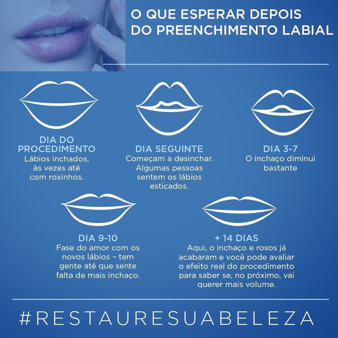 Ana Cristina Da Cruz Silva-98