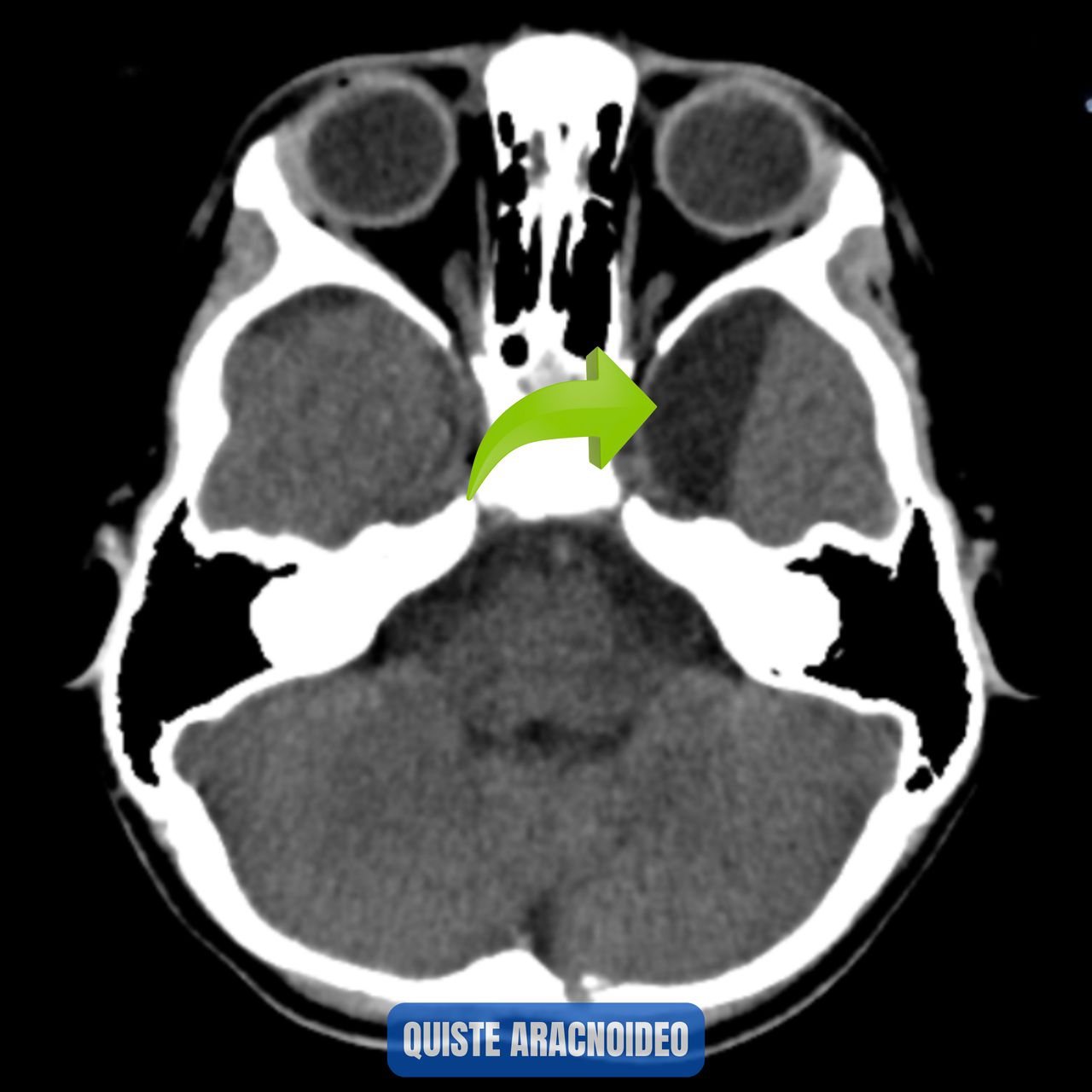 David Tafur Muñoz-1043