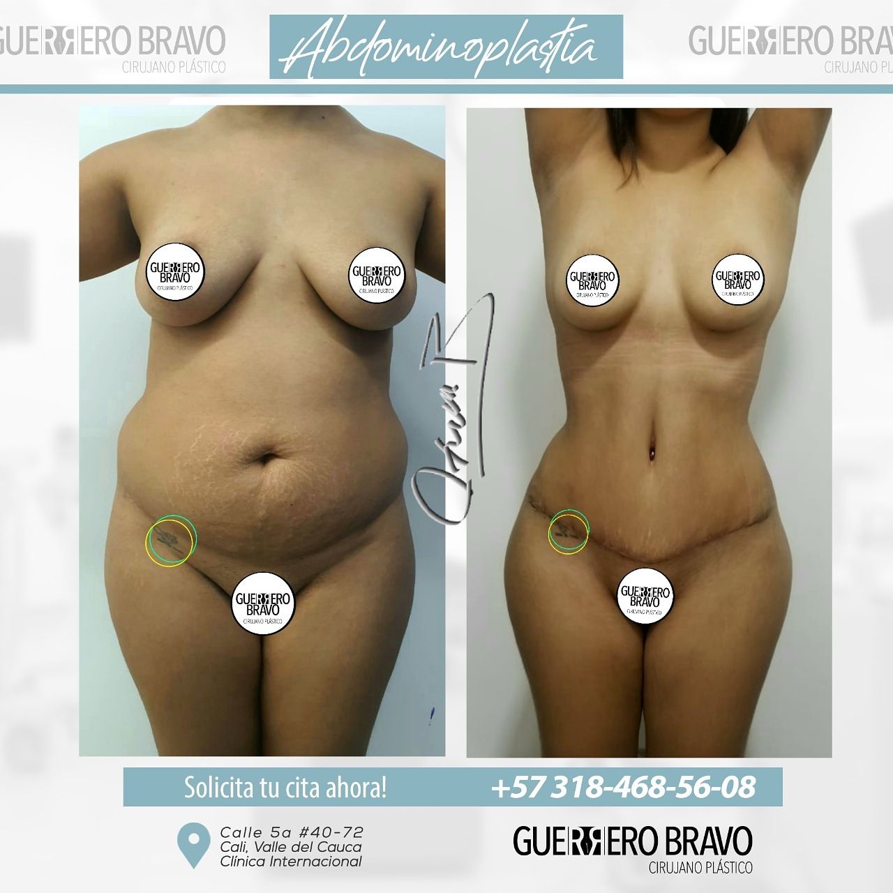 Camilo Guerrero Bravo-67