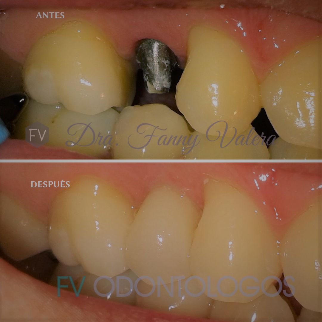 Fanny Valera Velásquez-102