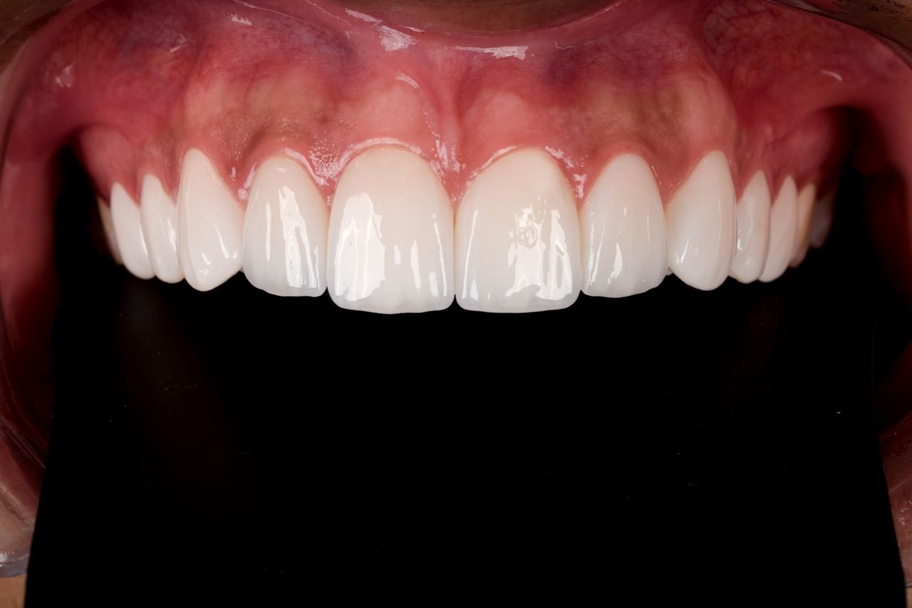 Cristian Pastrana Corrales-4