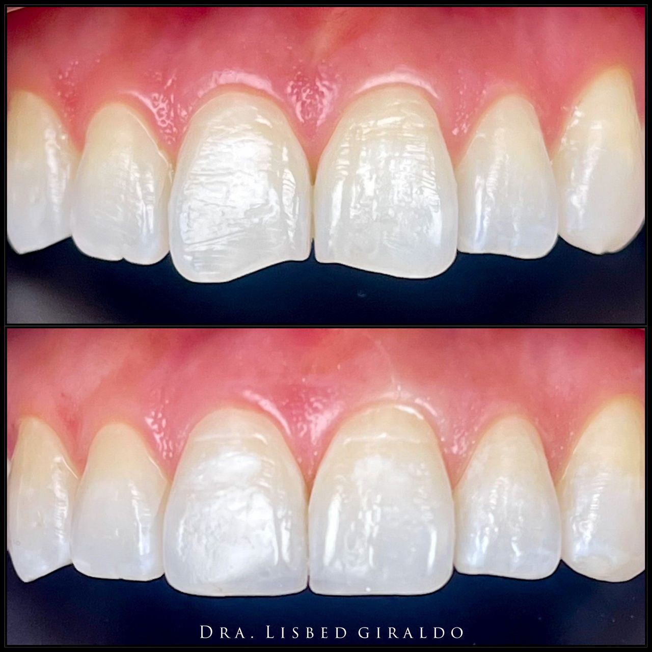 Lisbed Giraldo Olarte-19