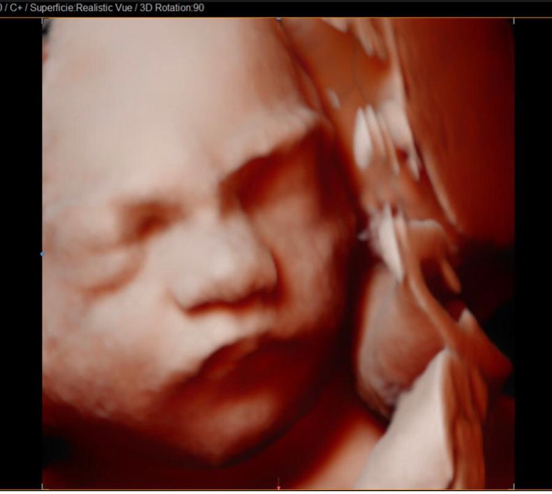 Jonh Harold Alvis Botello-21