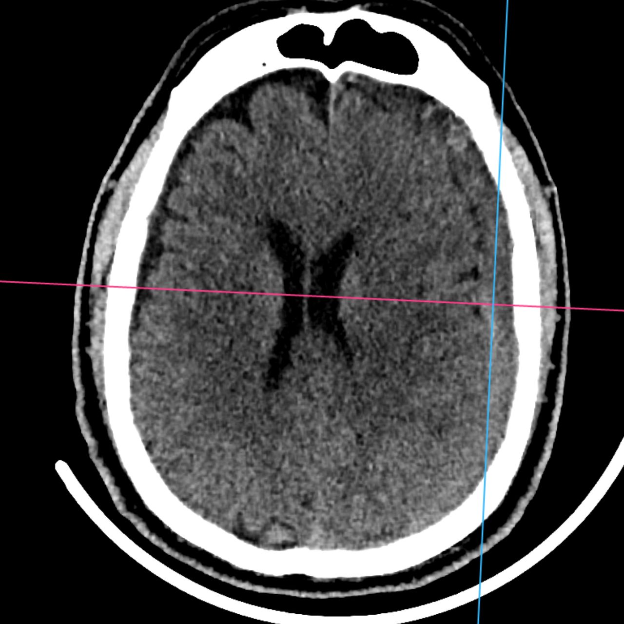 David Tafur Muñoz-2478
