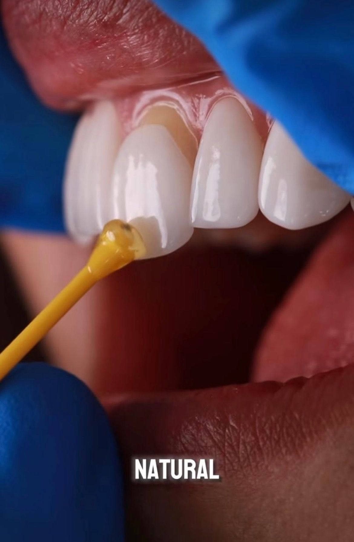 Nazinsky Rodriguez Arias-3