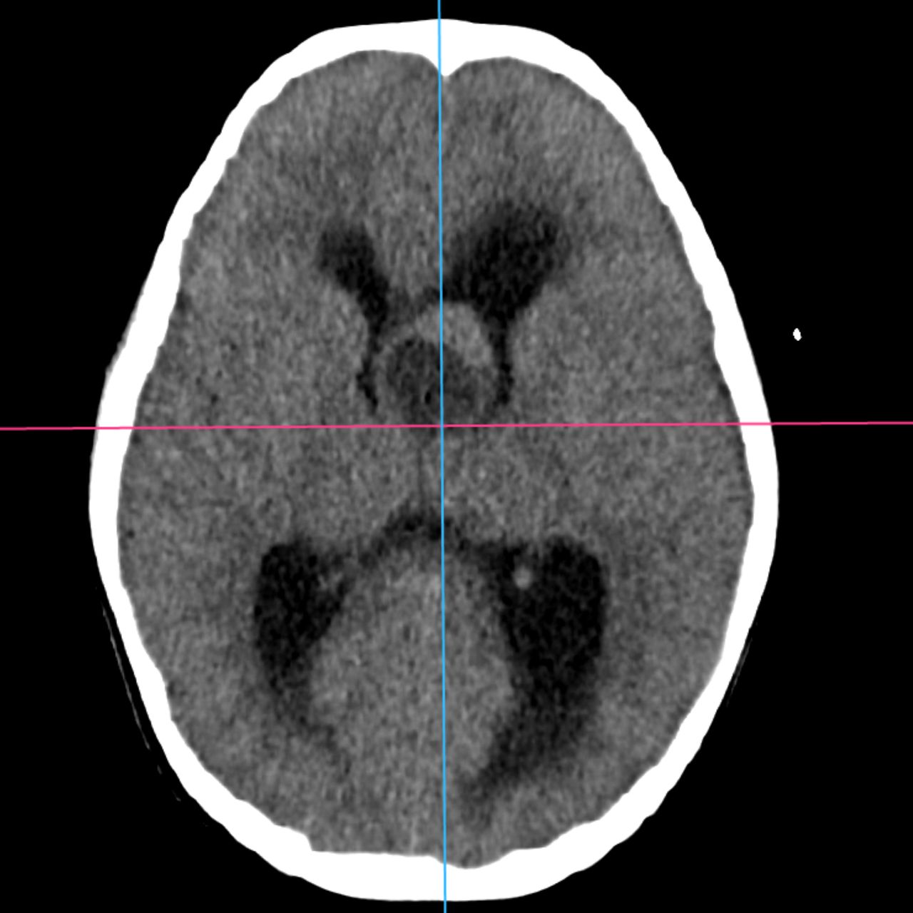 David Tafur Muñoz-1896