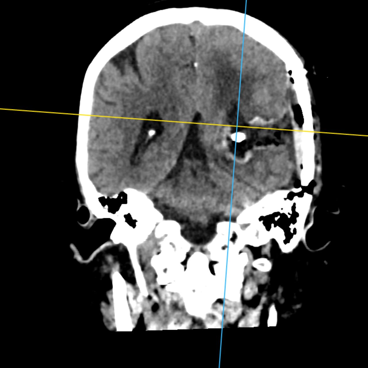 David Tafur Muñoz-2070