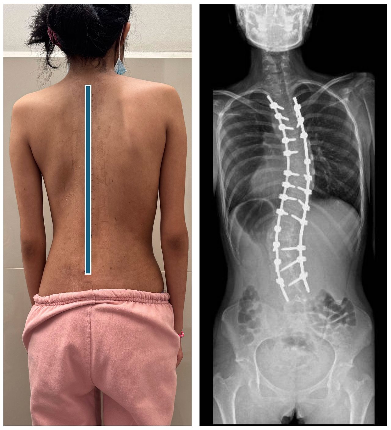 Ramiro Cieza Ojeda-12