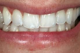 Gersa A. Domingues E Silva-3