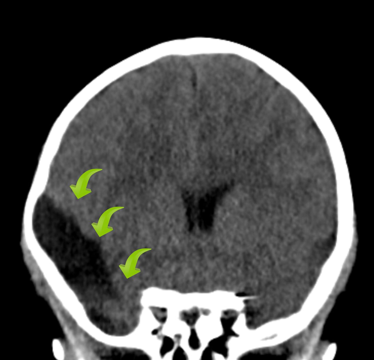 David Tafur Muñoz-1994