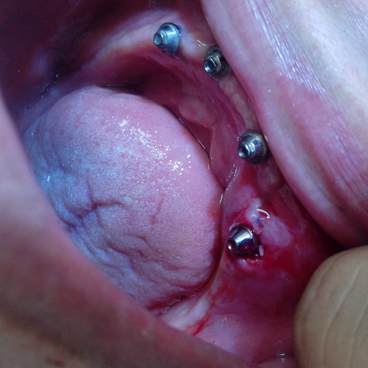 Gabriel Yehuda Antebi-9