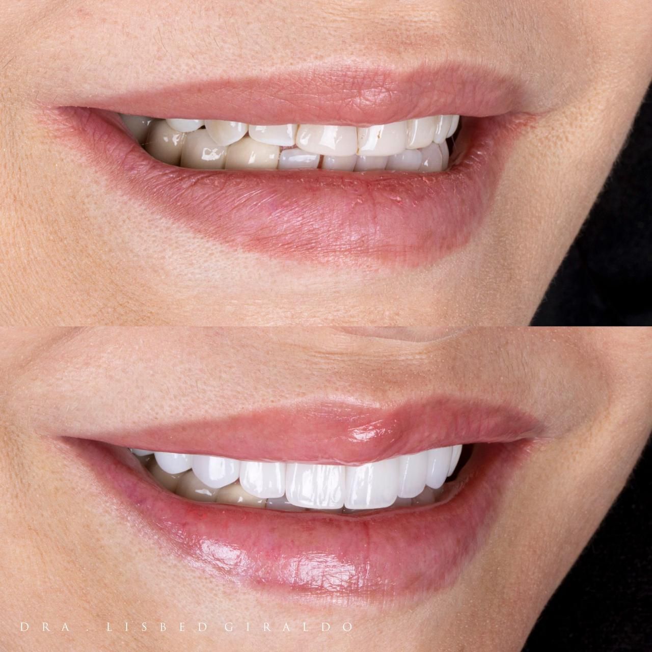 Lisbed Giraldo Olarte-40