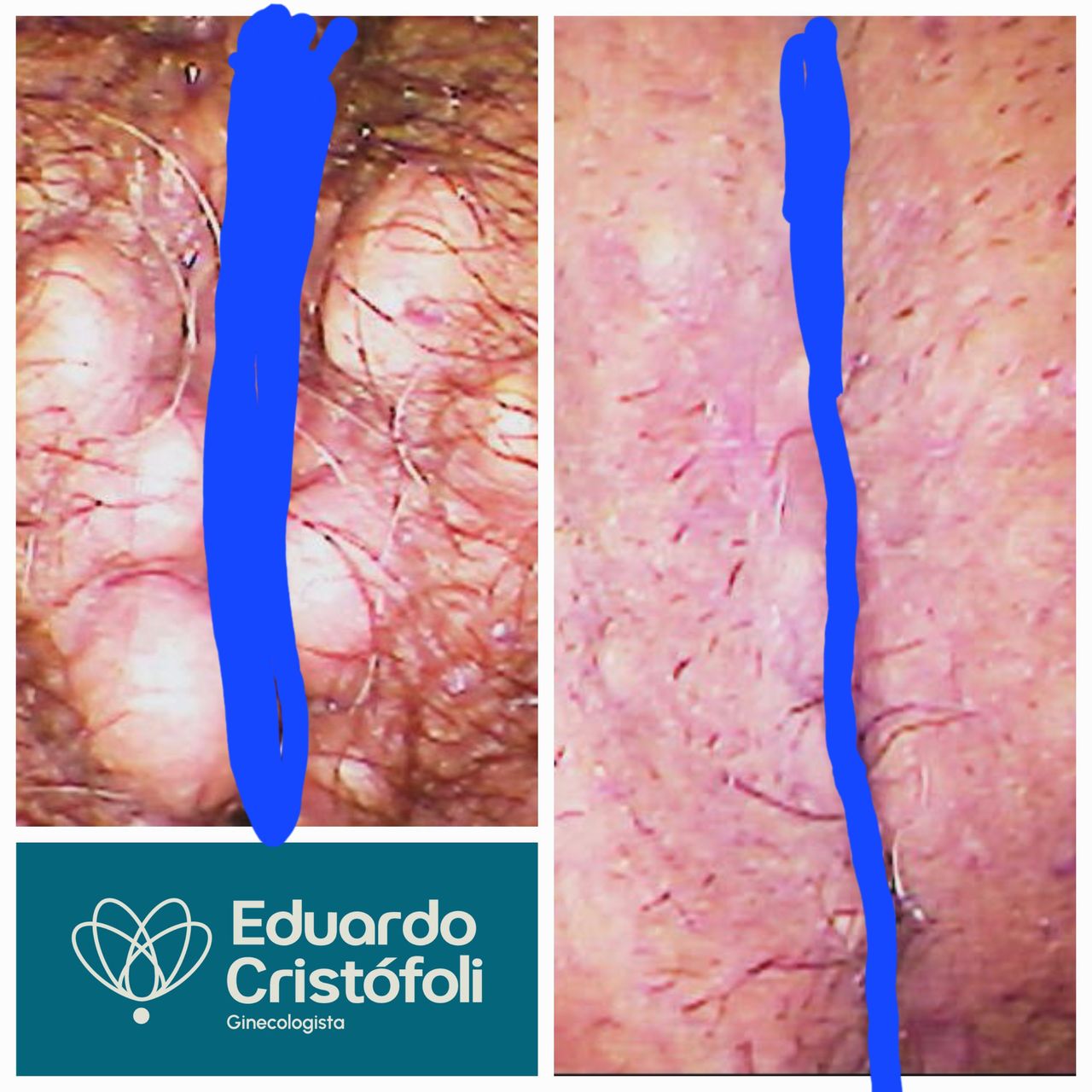 Eduardo Cristófoli Silva-14