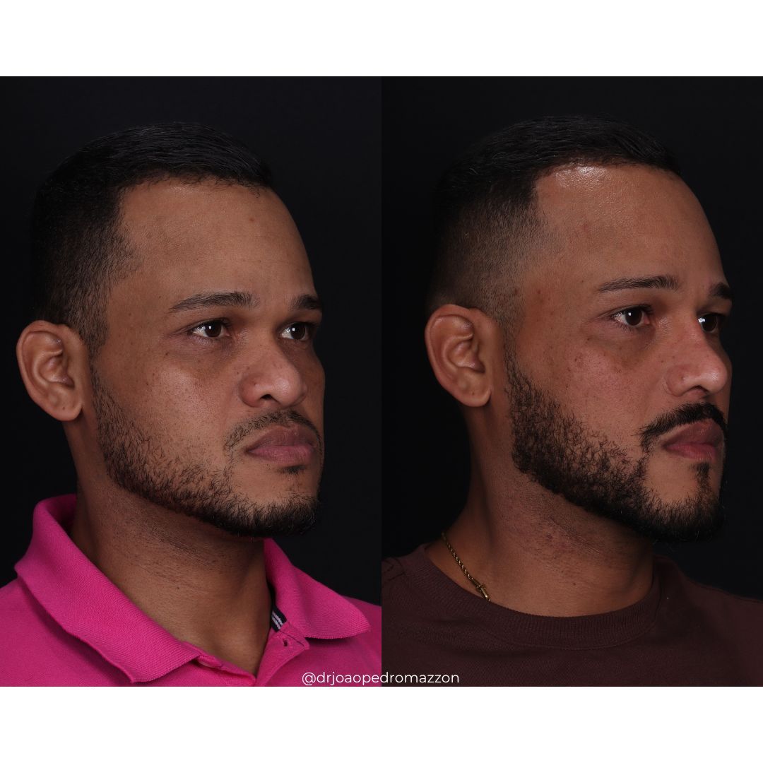 João Pedro Paulino Mazzon-56