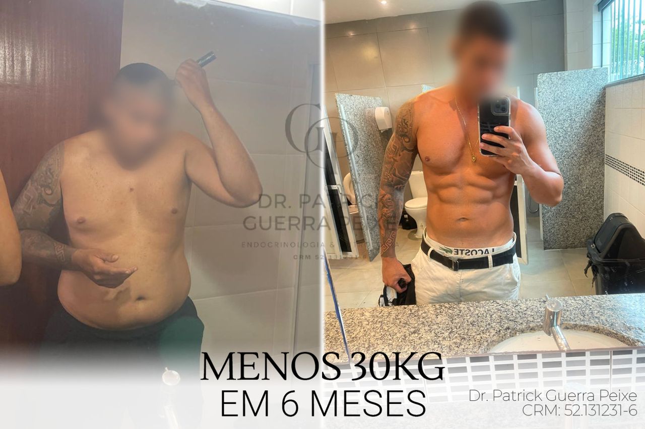 Patrick Guerra Peixe-1