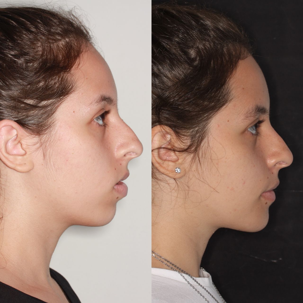 Raffael Maron Vieira De Noronha-29