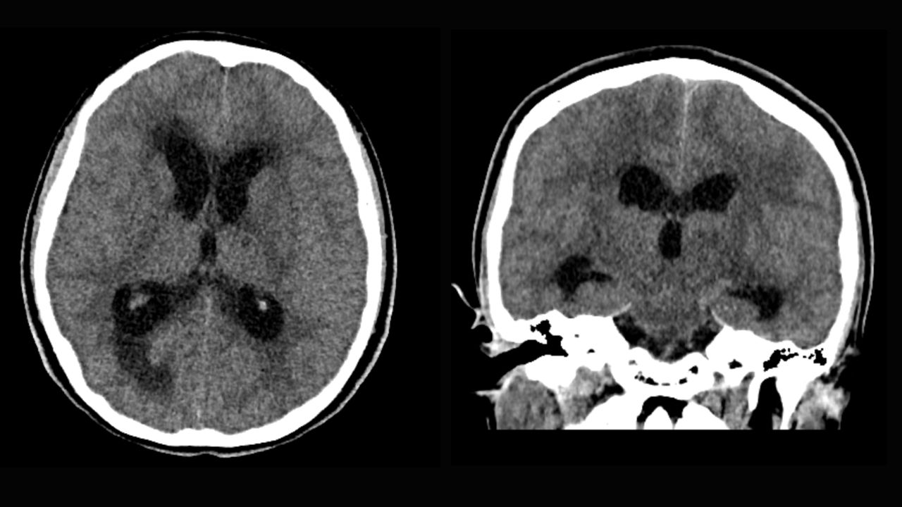 David Tafur Muñoz-1302