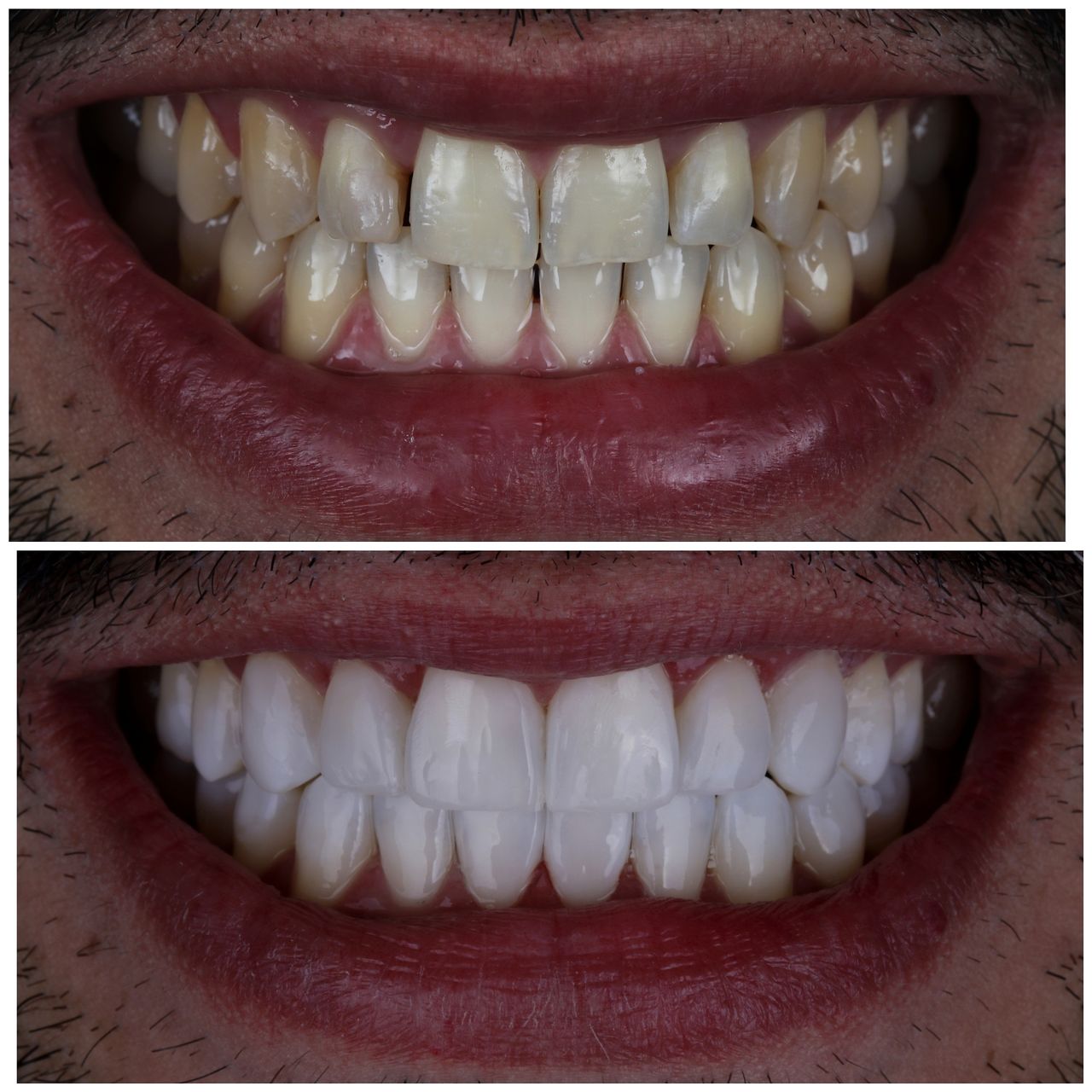 Daniel De Souza Pereira-69