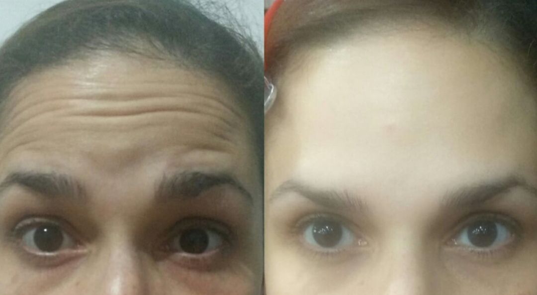 Fernando Vasquez Maldonado-8