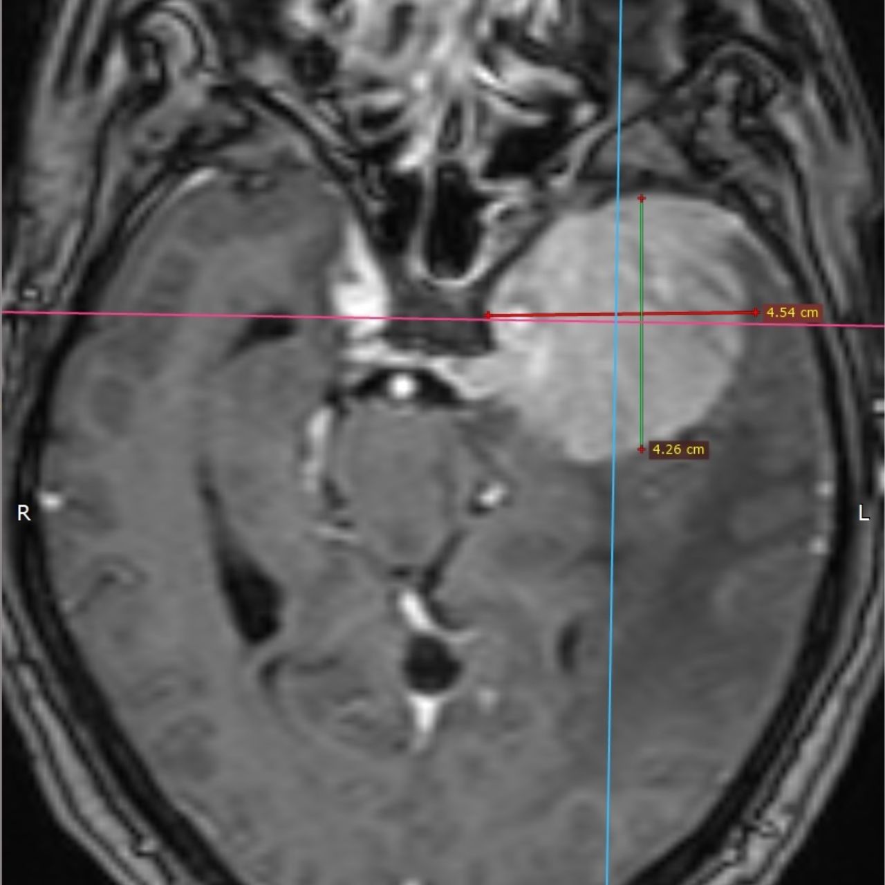 David Tafur Muñoz-1498