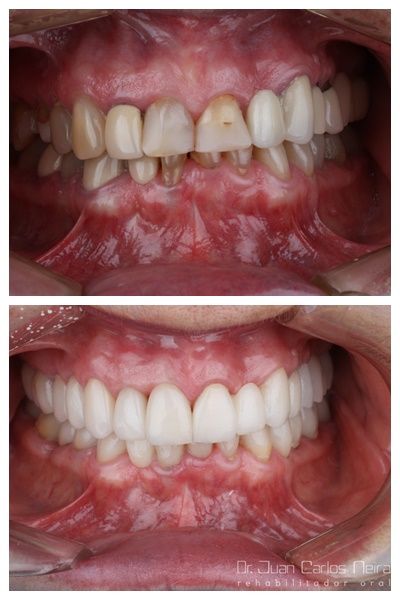 Juan Carlos Neira Rueda-15