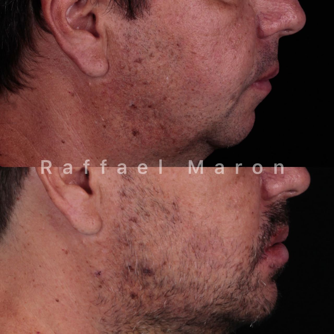 Raffael Maron Vieira De Noronha-6