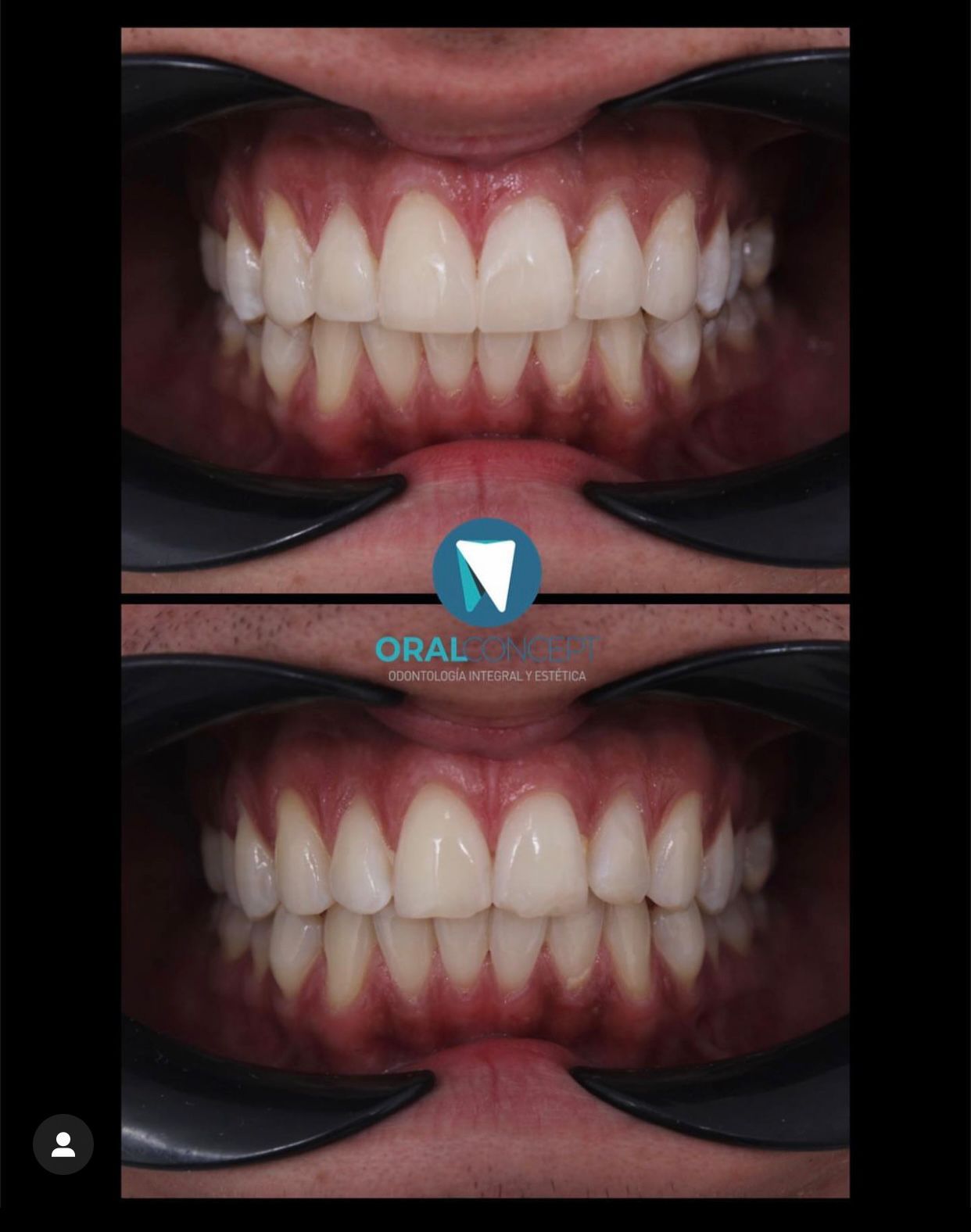 Andrés Mauricio Yepes Vargas-4