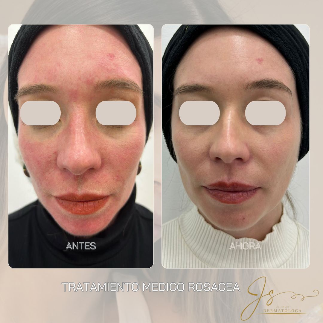 Jasiel Sarai Salas Gomez-8