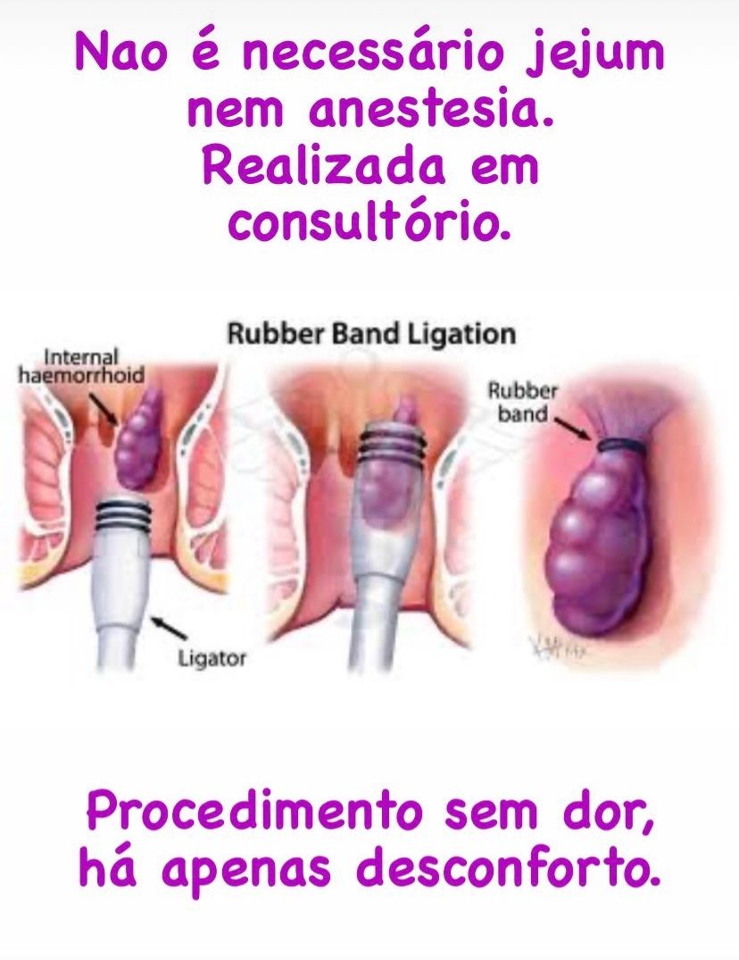 Andrea Pecci Rabello-10