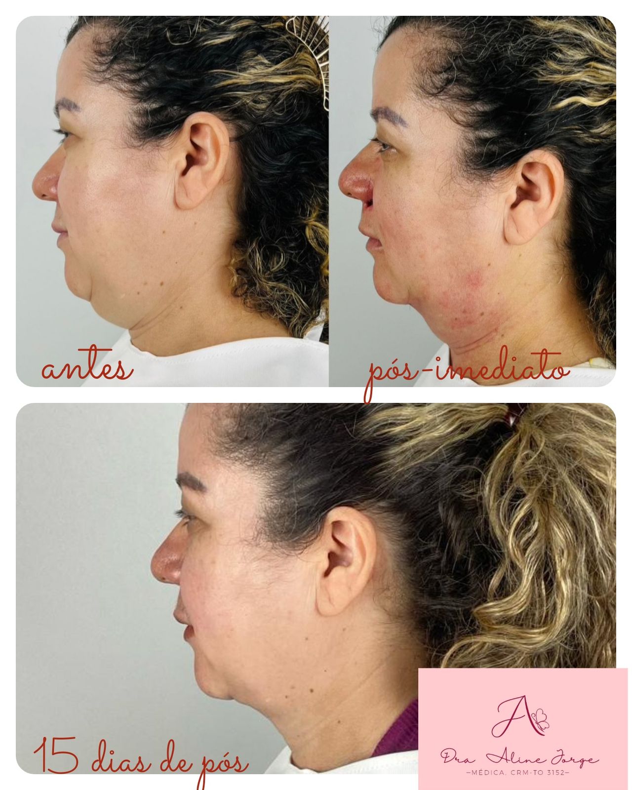 Aline Sousa Jorge-9