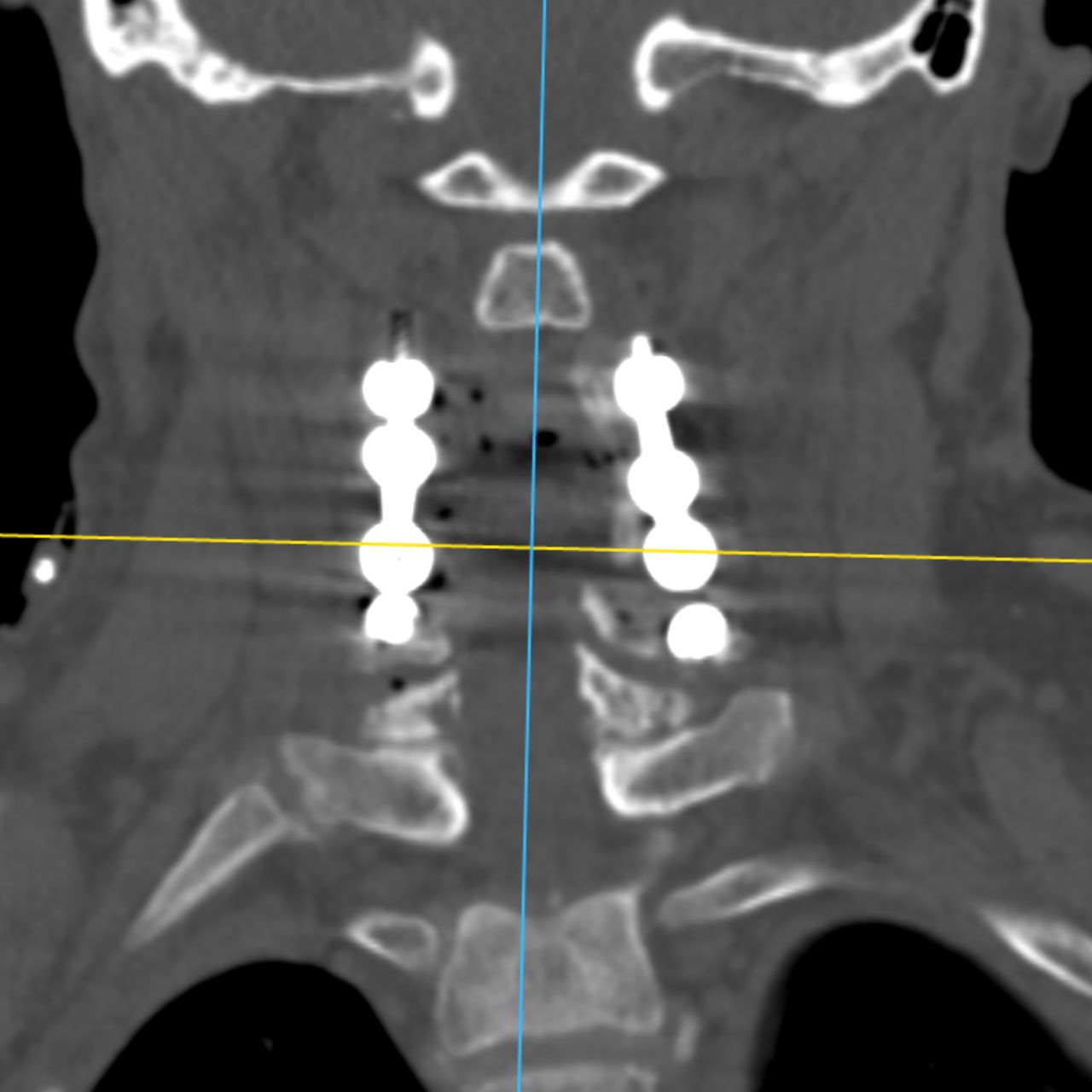 David Tafur Muñoz-2012