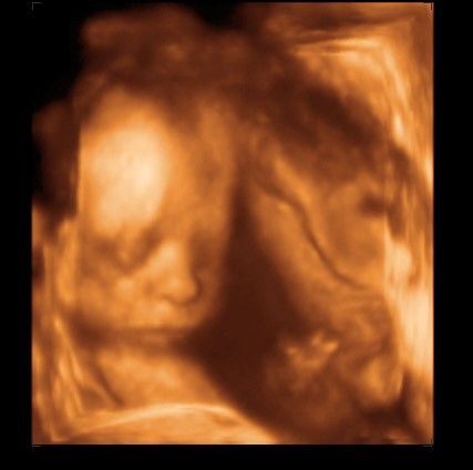 Diego Hernando Diaz Botero-3