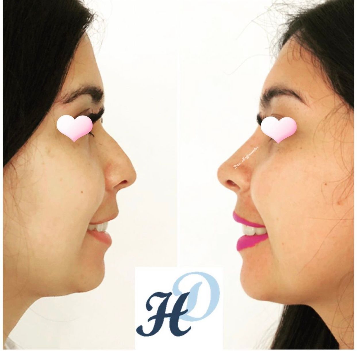 Daniela Hoffmeister-5