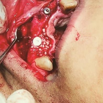 Gabriel Yehuda Antebi-8