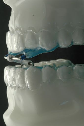 Aarón Núñez Osses-6