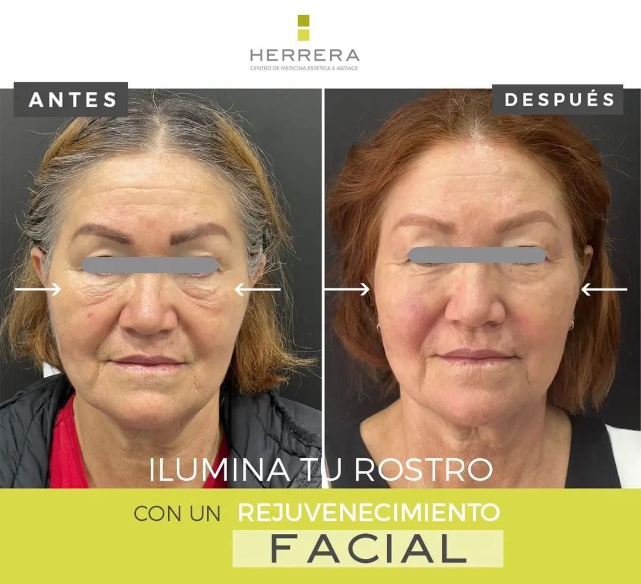 Andrea Alonso Herrera-4