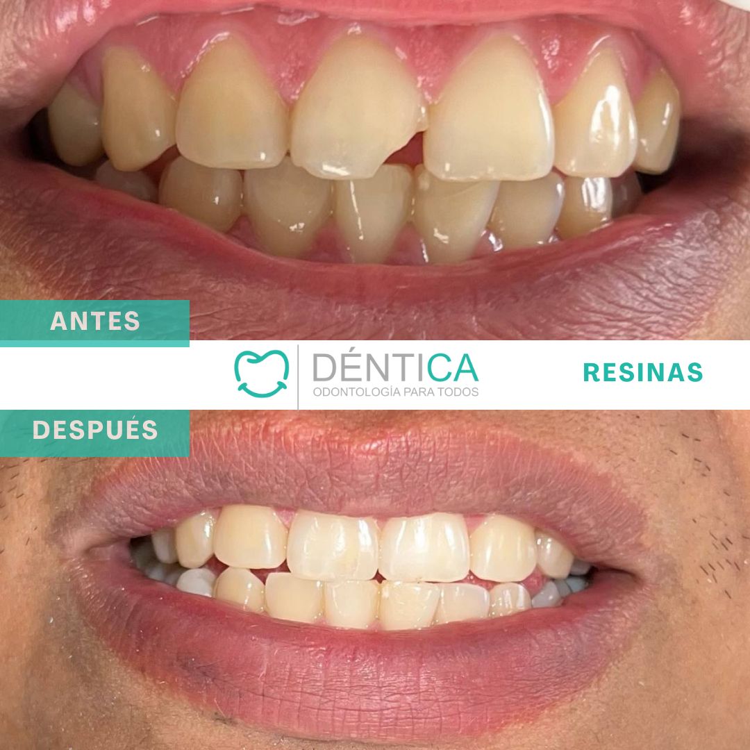 Estefani Canches Caballero-17