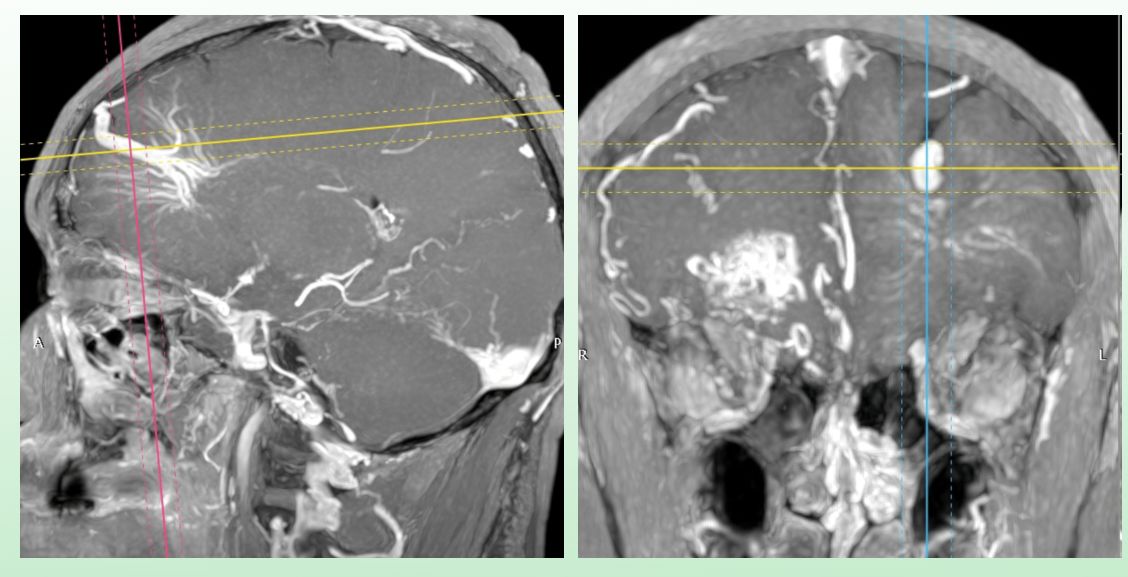 David Tafur Muñoz-2276