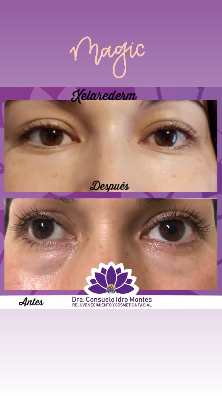 María Consuelo Idro Montes-5